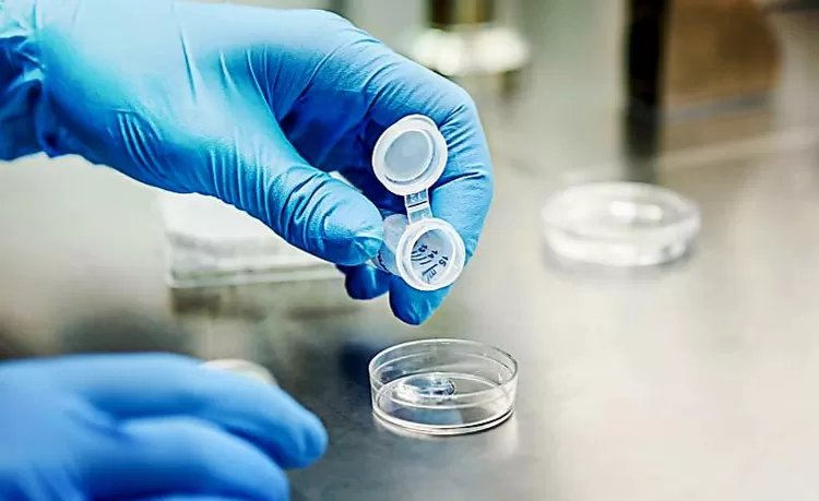 Prosedur simpan beku atau egg freezing. 