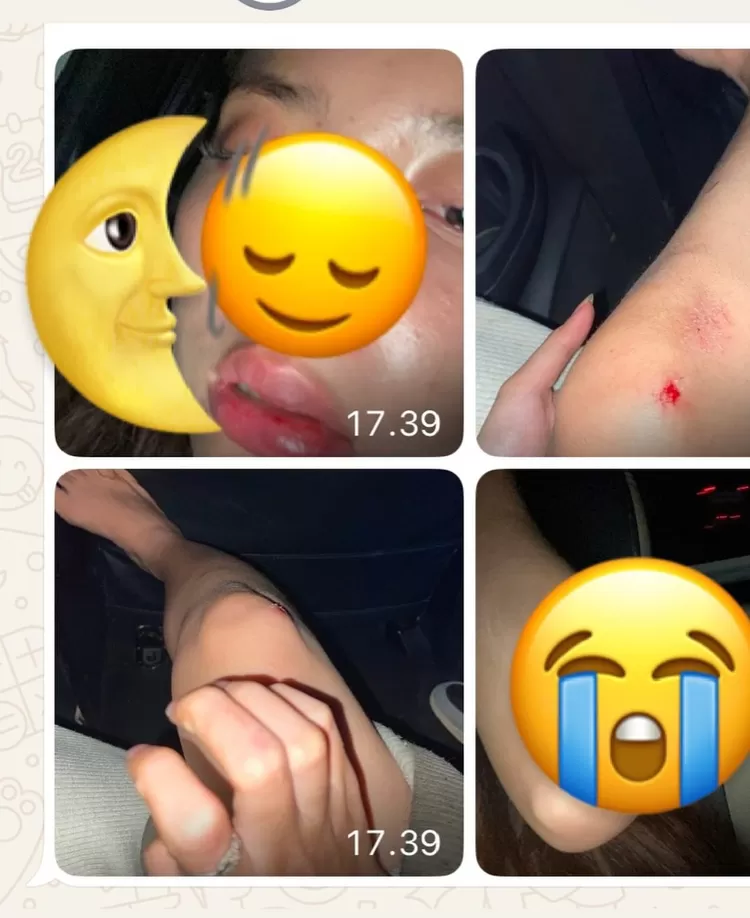 Anggota DPRD Pandegelang, Banten diduga aniaya mantan pacar.