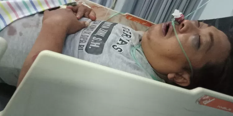 Juwari salah satu korban kecelakaan di Plandaan yang mengalami luka lebam pada bagian mata dan kepala