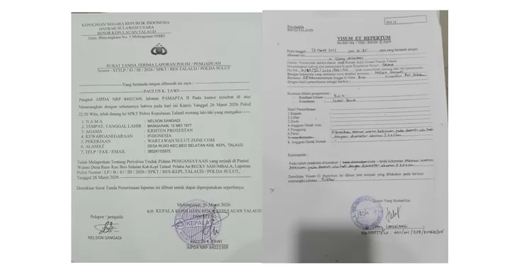 Laporan Polisi dan Hasil Visum, Penganiayaan dari Oknum TNI Talaud