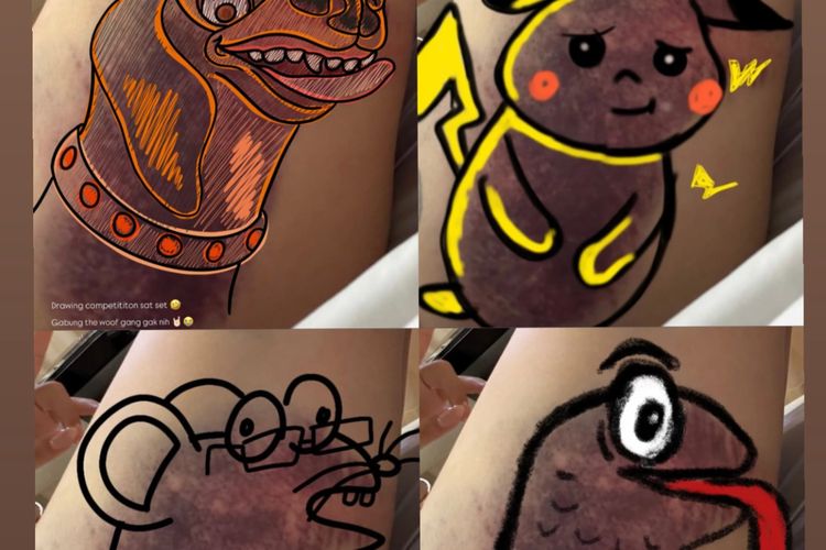 Usai Kecelakaan, Wendy Walters Adakan Lomba Gambar Lebam Demi Tutupi Luka