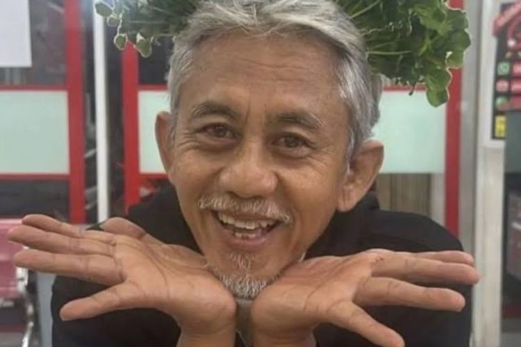 Ketahui Penyumbatan Pembuluh Darah Batang Otak yang Diderita Epy Kusnandar