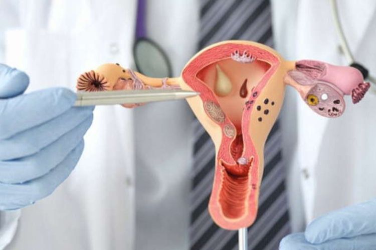 129 Perempuan di Sumbar Positif HPV DNA pada 2025, DWP Perkuat Pencegahan Kanker Serviks