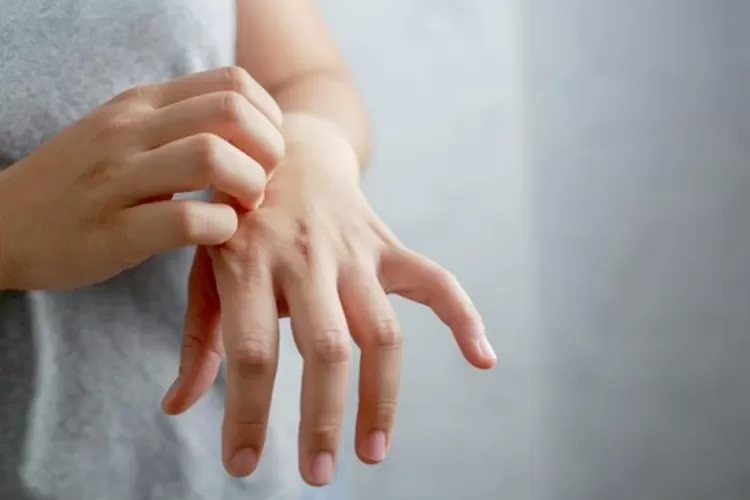 Ilustrasi gatal di kulit (freepik)