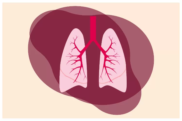 Apa Itu Pneumonia Atau Infeksi Paru-paru Yang Diidap Tjahjo Kumolo ...