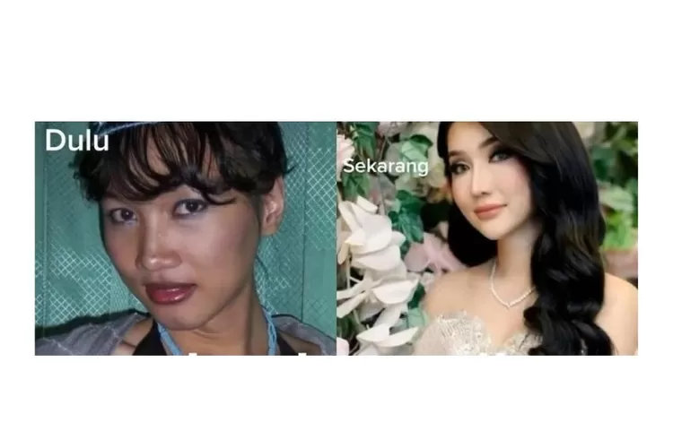 Berubah Drastis Ini Wajah Lucinta Luna Setelah Oplas Netizen Cowok Saja Bisa Jadi Cantik