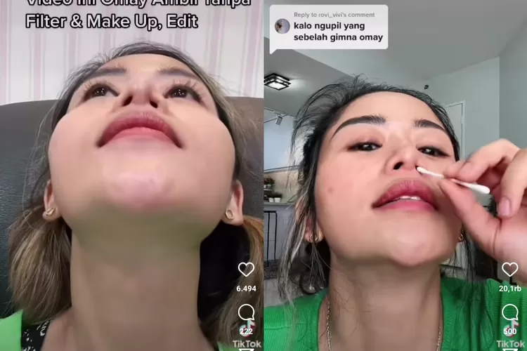 Tiga Kali Operasi Plastik Lubang Hidung Youtuber Farida Nurhan Malah Tak Simetris Jari Gak