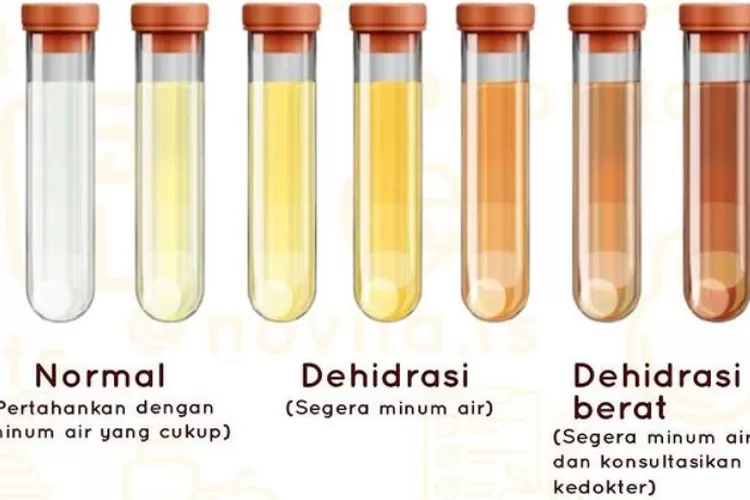 Kenali Penyakit Dalam Tubuh Anda Lewat Warna Urine