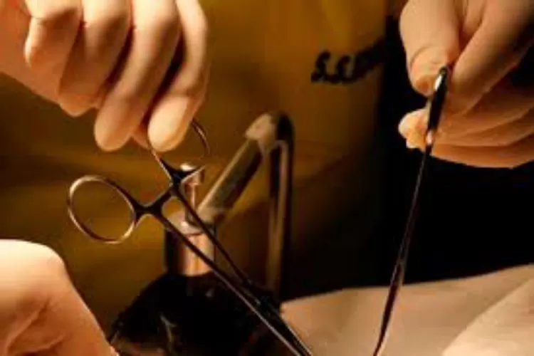 Ilustrasi sunat  (Istimewa )