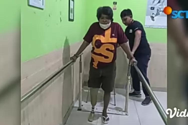 Potret Suti Karno kenakan kaki palsu pasca amputasi (YouTube SCTV)