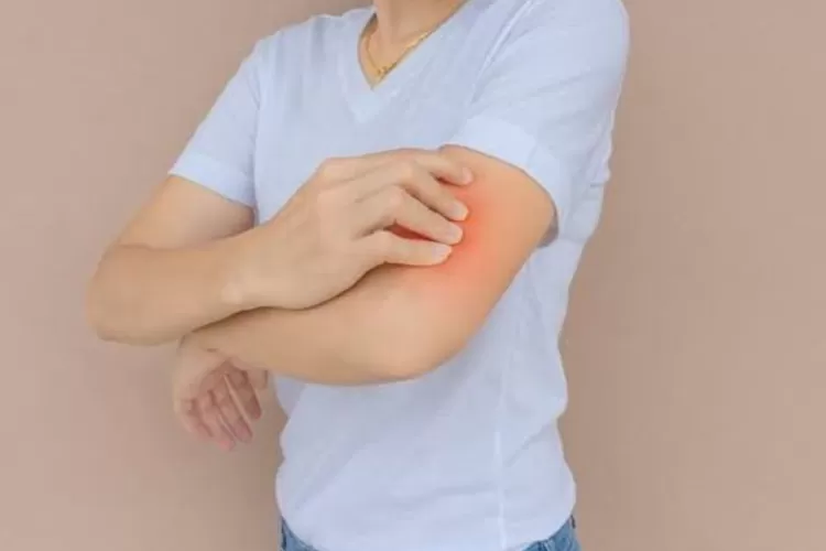 Foto ilustrasi rasa gatal yang sebabkan alergi bisa di atasi dengan mengkonsumsi air kunyit (sehatQ)