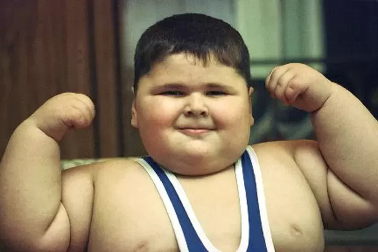 Ilustrasi Obesitas  (Freepik)