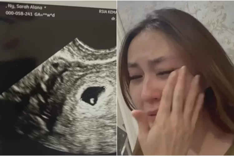 Sarah Gibson alami keguguran (instagram @sarahgibson21)