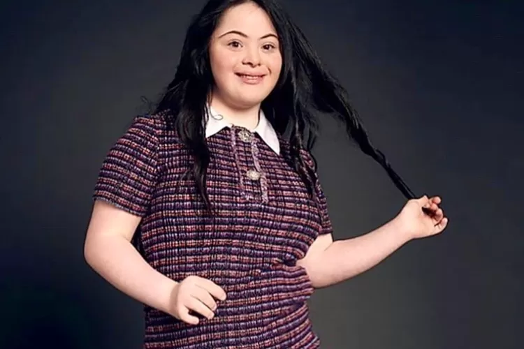 Kisah Inspiratif Model Down Syndrome Yang Tampil Untuk Gucci Indozone Beauty 1755