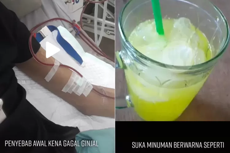 Pemuda Ini Kena Gagal Ginjal Akibat Suka Minuman Soda Tapi Kurang Minum Air Putih Indozone Health 6002