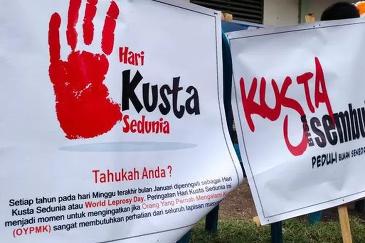 28 Januari Hari Kusta Sedunia 2024: Tema Dan Sejarahnya - Info Mase