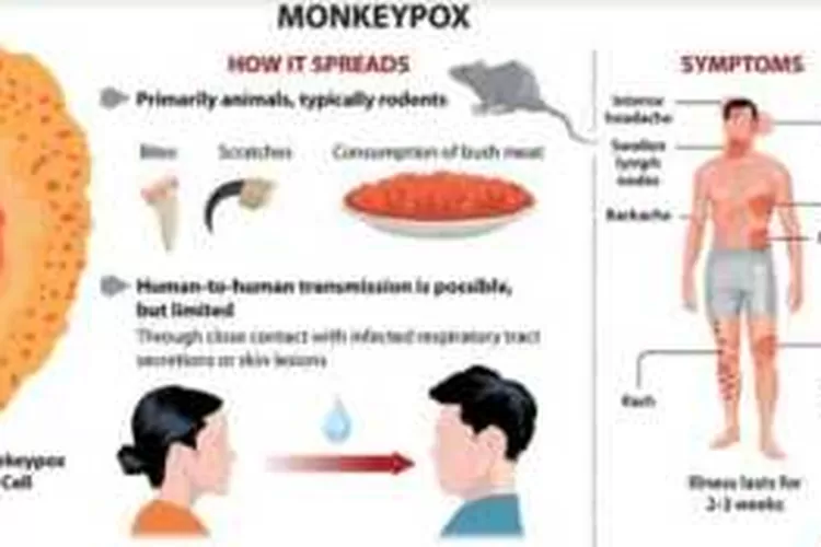 Kenali Cara Penularan Dan Gejala Cacar Monyet - Jagosatu