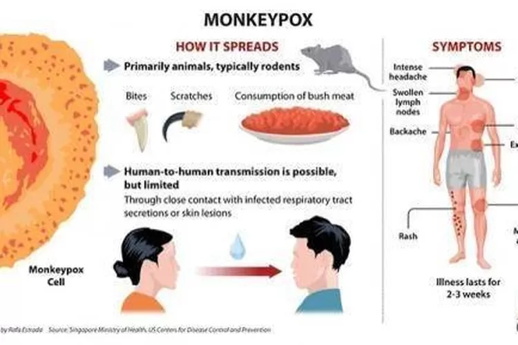 Sudah Masuk Singapura, Kemenkes: Cacar Monyet Belum Sampai Indonesia ...