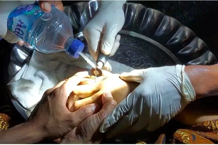 Momen petugas damkar lepaskan cincin di jari jenazah