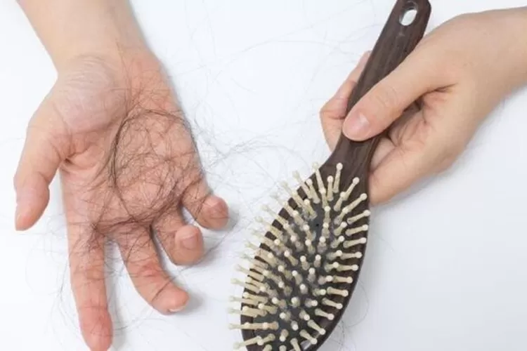 rambut rontok (website : CNN Indonesia)