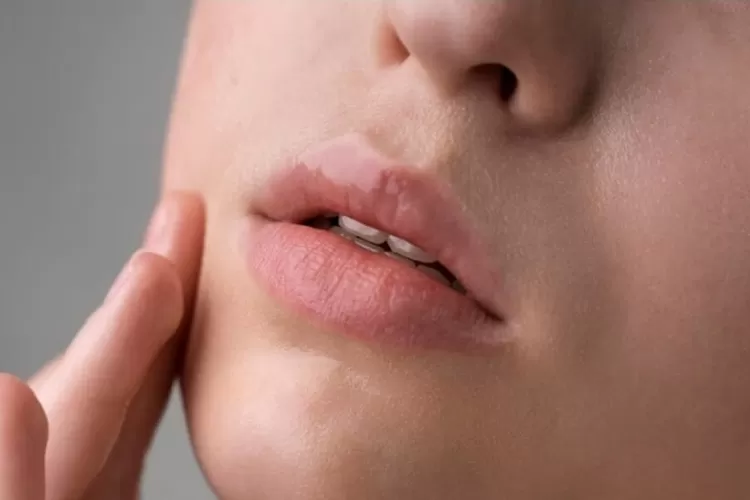 Tips mengatasi pigmentasi bibir yang bisa dilakukan di rumah. ( (Freepik/freepik))