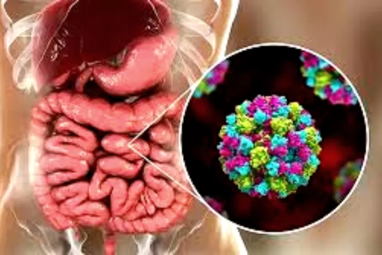 Ilustrasi Gastroenteritis (Halodoc)