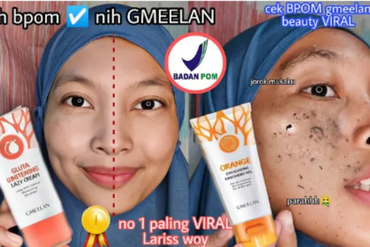 YouTuber Ini Review Viral Peeling Gel dan Lazy Cream Gmeelan Skincare: Menjijikkan Banget!