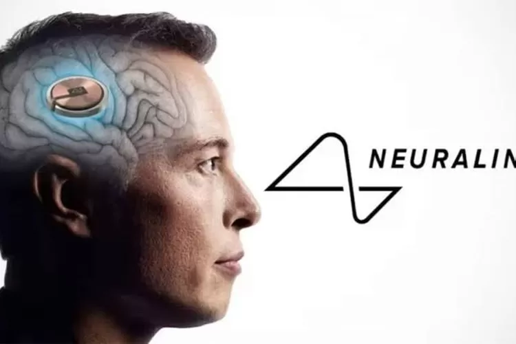 Neuralink sukses tanam chip otak pada pasien kedua, memungkinkan kontrol dunia digital hanya dengan pikiran.  (Foto/Firstpost)