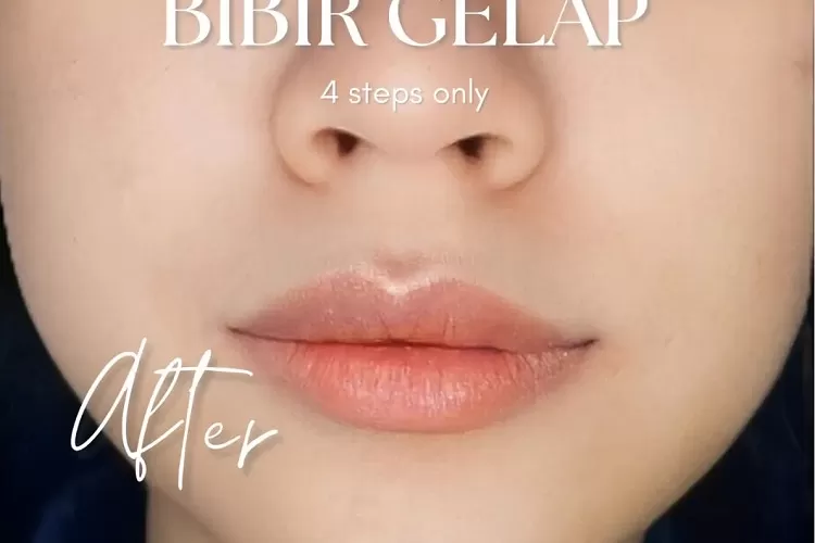 Tips Mengatasi Bibir Hitam Bagi Wanita (Topmedia.co.id / Istimewa)