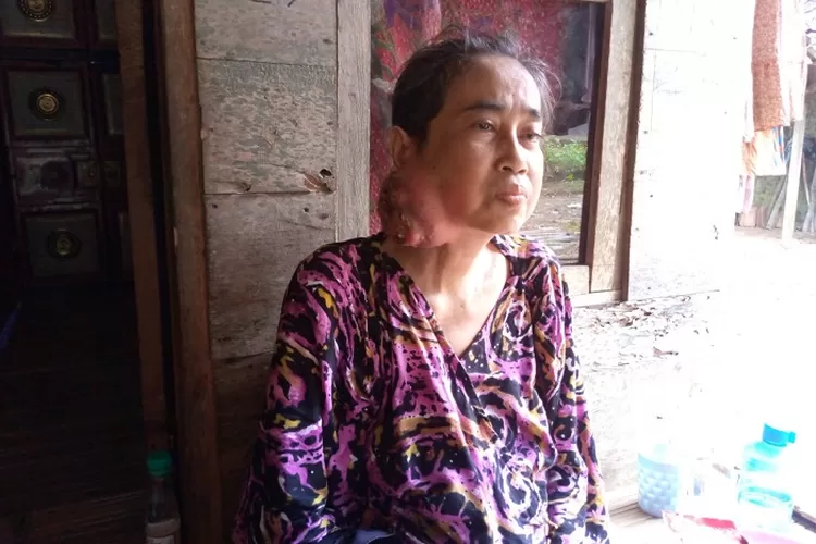 Wartasih (50), warga Kampung Ciakar, Desa Rancapinang, Kecamatan Cimanggu, Kabupaten Pandeglang, tak memiliki biaya untuk mengobati tumor ganas di lehernya.