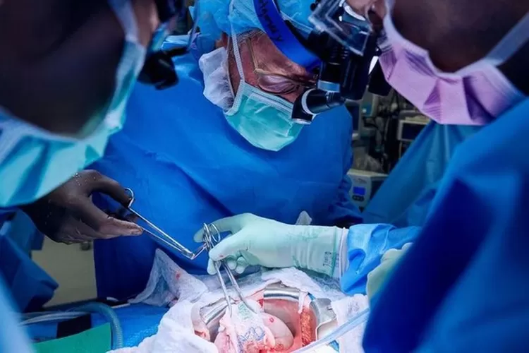 Proses operasi cangkok ginjal babi.  (Foto: JOE CARROTTA/NYU Langone Health)