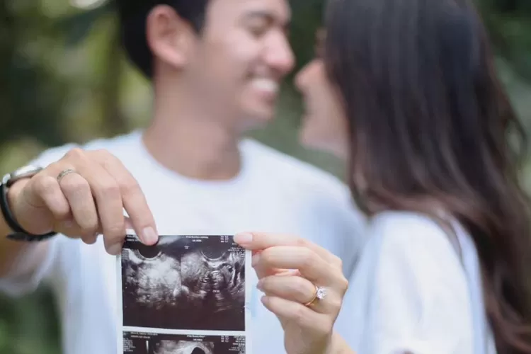 Postingan foto kehamilan anak pertama pasangan Belva Devara dan Sabrina Anggraini  (Instagram./belvadevara)