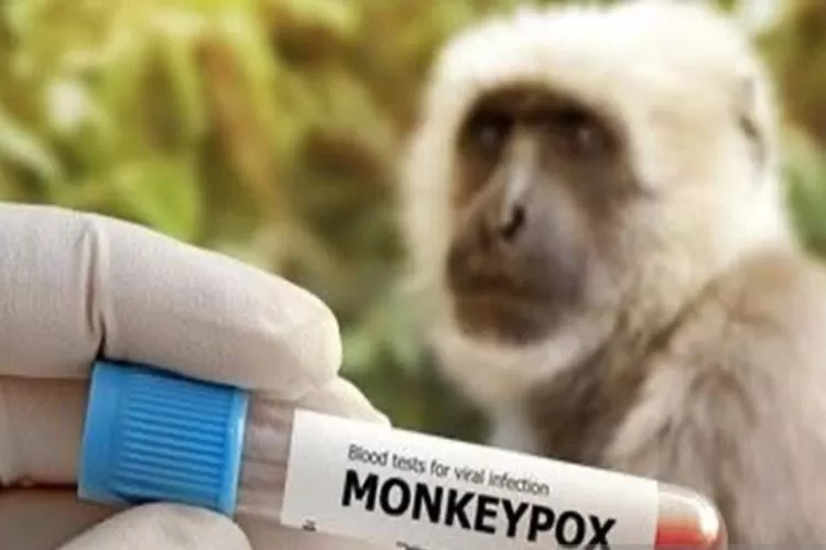 Ilustrasi - penyakit cacar monyet.  (FOTO.ANTARA-HO/IST/hmskominfokalsel)