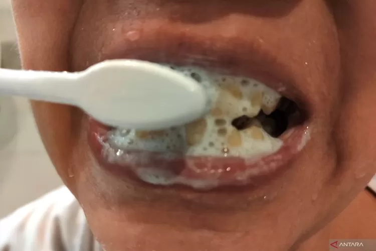 Ilustrasi - Menyikat gigi. ( ANTARA/Sizuka  &nbsp;)