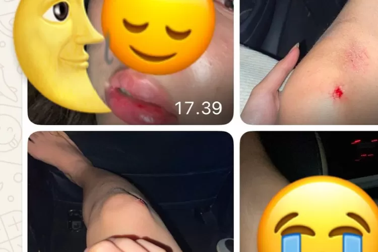 Anggota DPRD Pandegelang, Banten diduga aniaya mantan pacar. (Foto: Istimewa)