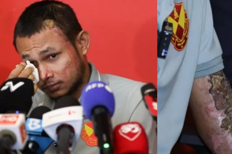 Potret kondisi pilu terkini dari pesepak bola timnas Malaysia, Faisal Halim (Instagram/@astroarenahd)