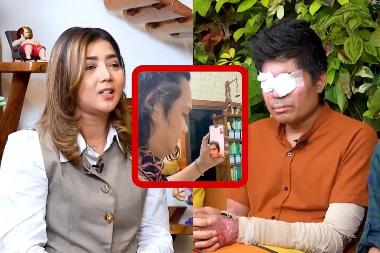 Potret Agus Salim korban penyiraman air keras Video Call Farhat Abbas ditanggapi Pratiwi Noviyanthi  (TikTok.com/farhatabbastiktok/YouTube.com/Curhat Bang Denny Sumargo)