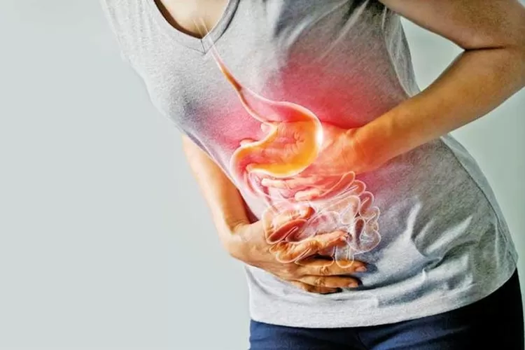 Ilustrasi  asam lambung kambuh bisa menyebabkan heartburn.