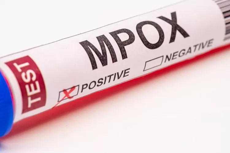 Ilustrasi MPOX (Getty Images/JUN LI)