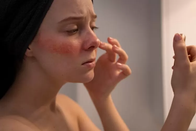 Cara Efektif Mengatasi sel Kulit Mati (tangkap layar Freepik)