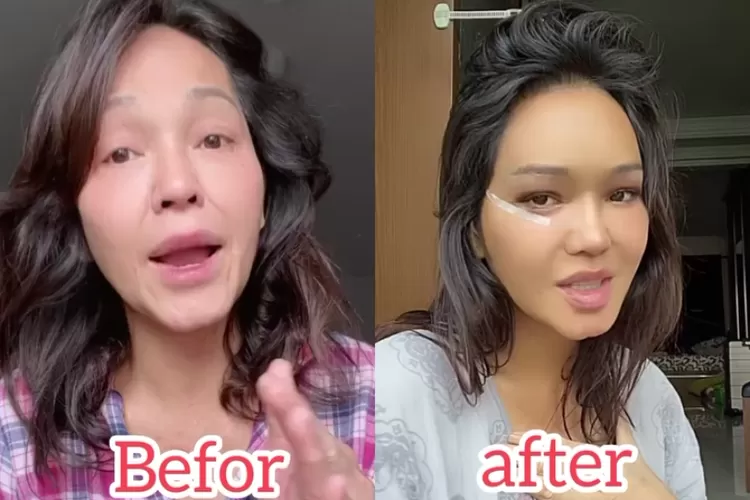 Bunda Corla unggah video pamer sebelum dan sesudah lakukan operasi plastik atay facelift, tuai respon netizen (Tangkap layar Instagram corla_2 )