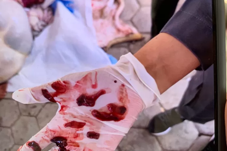 Cacing hati yang ditemuka di hewan kurban di sejumlah daerah di Kendal.  (edi prayitno/kontributor Kendal)