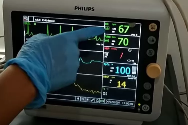 Cara Membaca Monitor Icu Mengenal Parameter Dan Jenis Vrogue Co