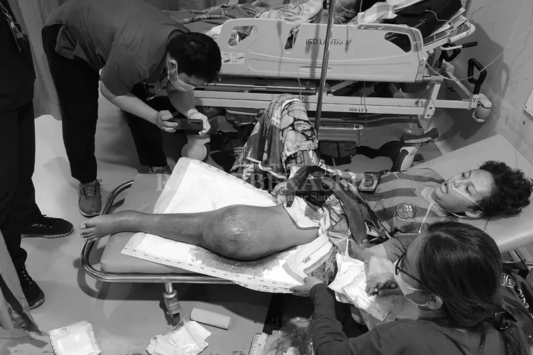 Siswa SDN di Bekasi yang diduga menjadi korban perundungan saat mendapatkan perawatan di rumah sakit. (Foto Radar Bekasi)