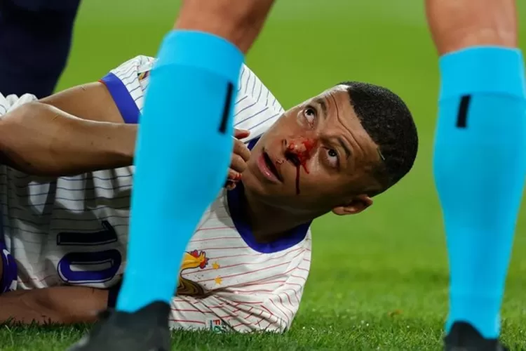 Kylian Mbappe diprediksi absen membantu Timnas Prancis di sisa laga fase grup Euro 2024 karena hidungnya patah (Getty Images/Soccrates Images)