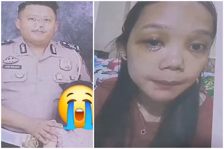 Oknum Polisi di Palembang Diduga Lakukan KDRT Terhadap Istri. (Foto/Instagram @melysaanggraini95.)