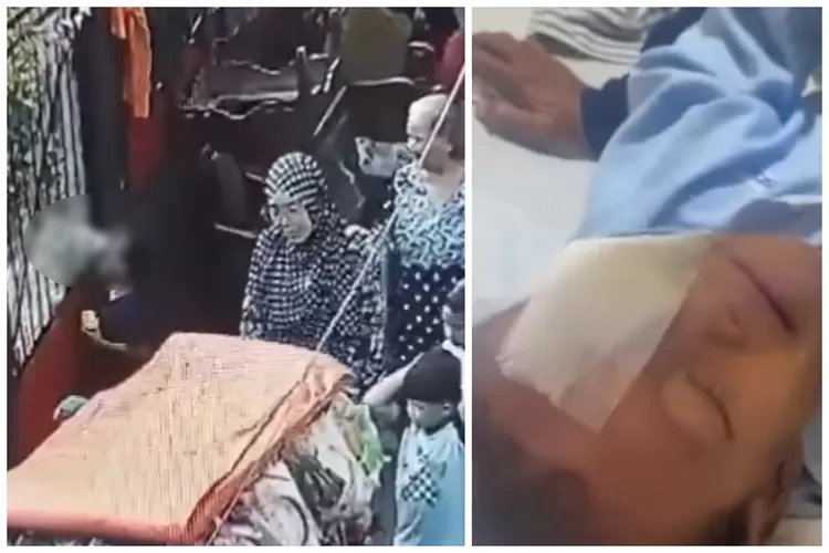 Mata Kiri Bocah 7 Tahun di Cipulir, Jakarta Selatan Digigit Anjing, Begini Kondisi Bocah Tersebut (Tangkapan layar/ Instagram @frix.id)