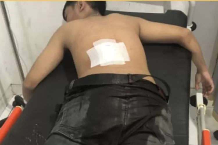Seorang remaja di Sukabumi menjadi korban kekerasan dalam perang sarung dan harus mengalami luka parah karena ditebas golok (ist)