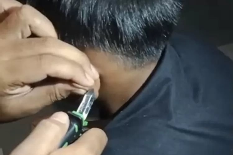 Petugas Damkar Sektor Cileungsi, Kabupaten Bogor saat berusaha melepas kail pancing yang menancap di telinga. (Damkar)