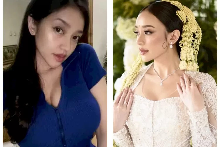 Dokter selebgram Amanda Zahra menikah lagi, isu lama soal perselingkuhan mantan suami dan terlibat open BO kembali mencuat (kolase)